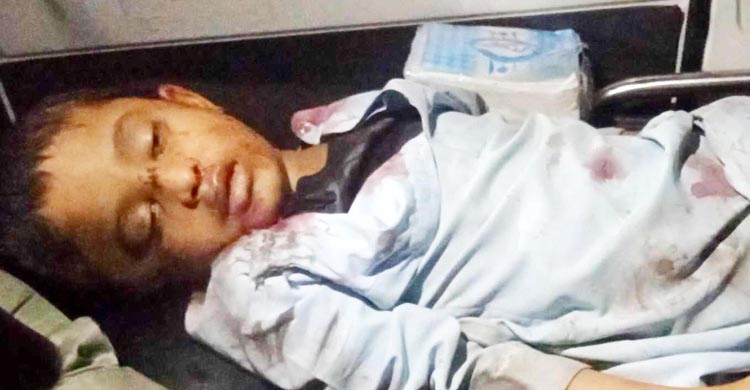 প্রাইভেটকারের ধাক্কায় প্রাণ গেলো মাদ্রাসা ছাত্রের