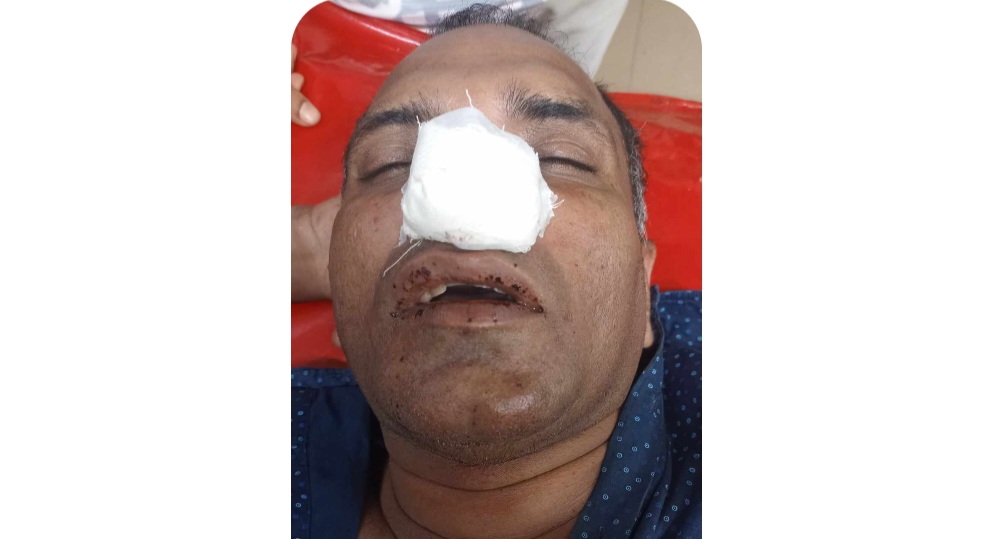 পুরানবাজারে সন্ত্রাসী হামলায় একই পরিবারের ৪ জন আহত