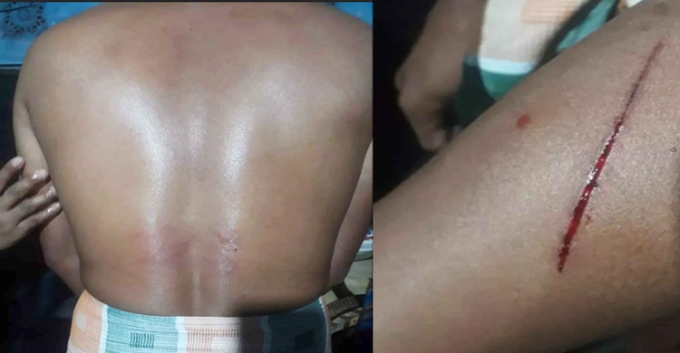 হাজীগঞ্জে ফল ব্যবসায়ীর ওপর হামলার ঘটনায় থানায় অভিযোগ