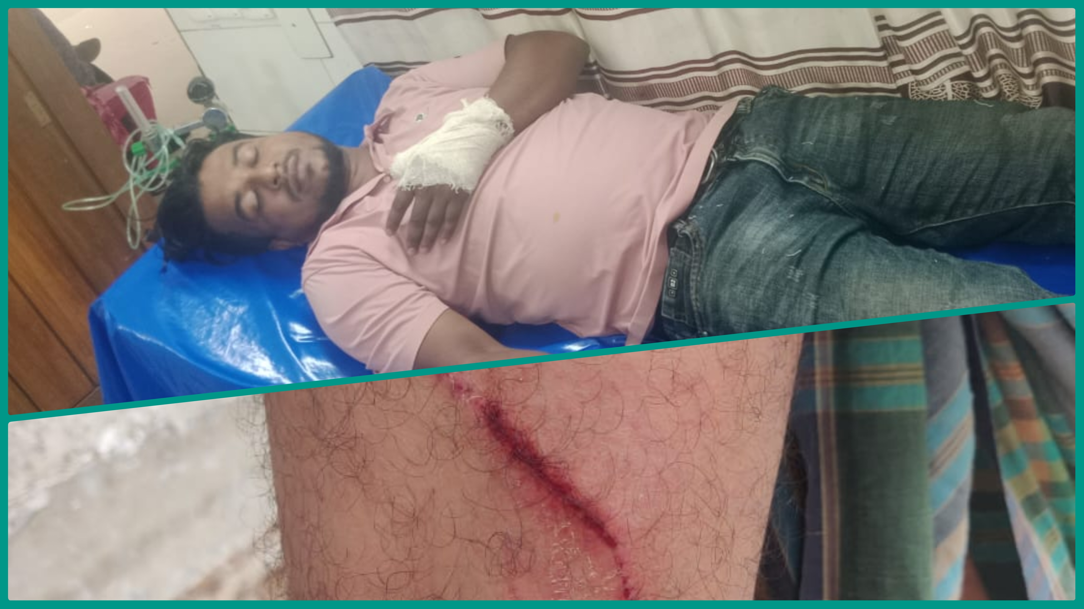 নোয়াখালীতে ফেসবুক স্ট্যাটাস নিয়ে ছাত্রদলের দুগ্রুপে সংঘর্ষ : আহত ৯