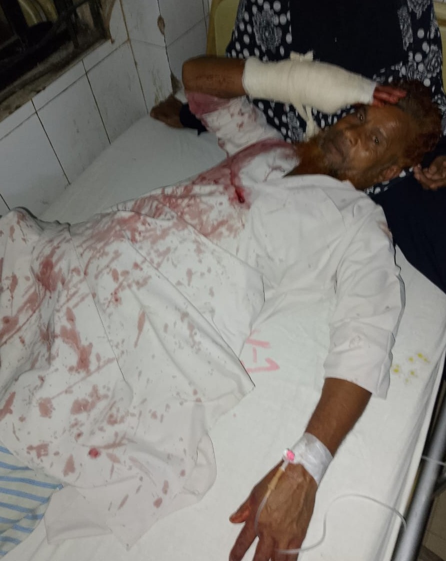 কোরবানির পশু বিক্রিতে চাঁদা না পেয়ে বৃদ্ধকে কুপিয়ে জখমের অভিযোগ