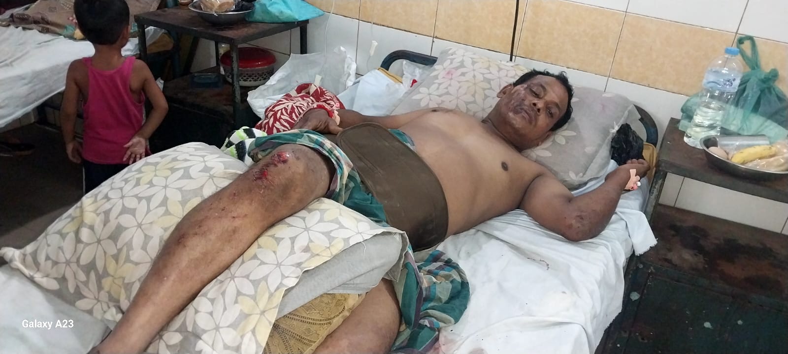 মানবিক আবেদন : অটোরিকশা চালক তপনের পাশে দাঁড়াই