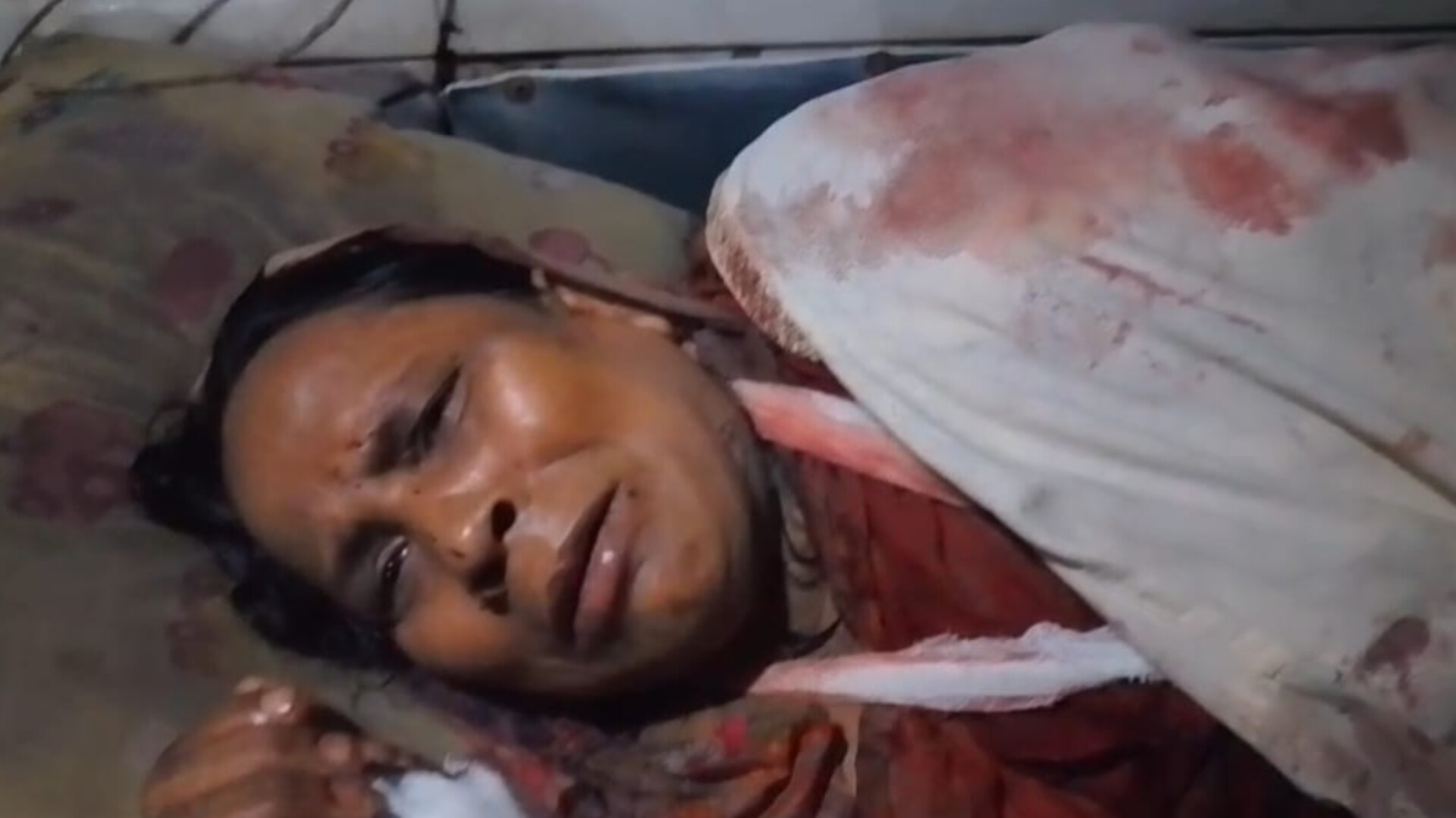 রায়পুরে বৃদ্ধা নারীকে কুপিয়ে জখম করলো মাদকাসক্ত যুবক