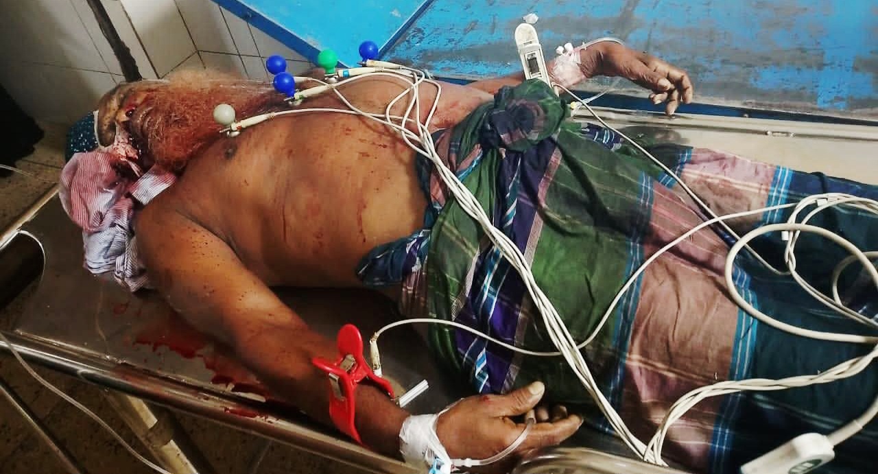 ঝড়ে গাছ পড়েছে চলন্ত সিএনজির ওপর, প্রাণ গেলো বৃদ্ধের