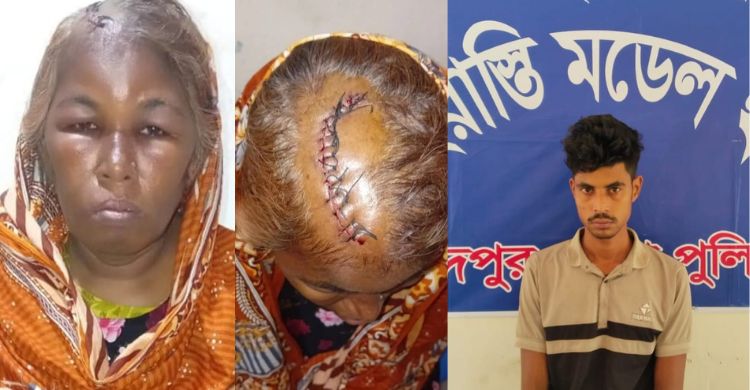 শাহরাস্তিতে মাথায় ১৪ সেলাই নিয়ে মাদকাসক্ত ছেলের বিরুদ্ধে মায়ের মামলা