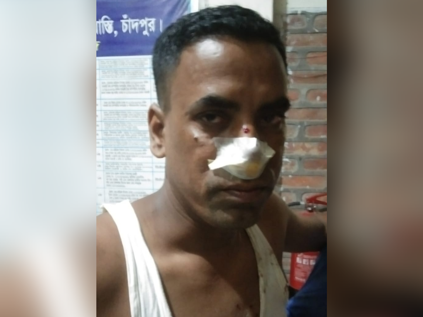 কচুয়ায় চাঁদা না দেয়ায় সেনা সদস্যকে পিটিয়ে পা ভাঙার অভিযোগ, ৩ জন গ্রেফতার