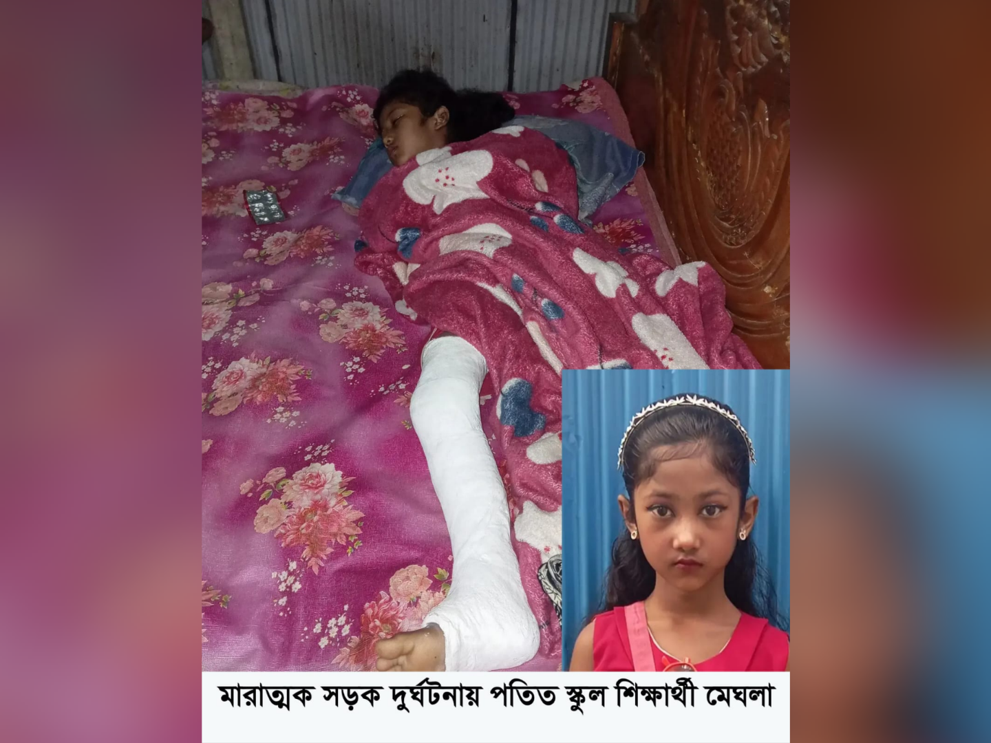 সড়ক দুর্ঘটনায় থমকে গেছে চতুর্থ শ্রেণির শিক্ষার্থী মেঘলার স্বপ্ন
