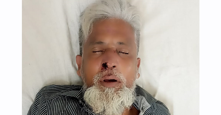 বিষ্ণুদীতে জমি মাপার বৈঠকে বিএনপি নেতাকে পিটিয়ে জখমের অভিযোগ