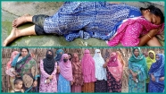 স্বামী-সতিনের ছোড়া গরম পানিতে ঝলসে গেলো গৃহবধূর শরীর