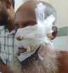হাজীগঞ্জে ভোরে শিয়ালের কামড়ে আহত ১০