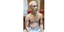২৫ বছর ধরে স্কিন সিরোসিসে আক্রান্ত  ফারুকের সাহায্যের আবেদন