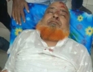 বাগাদী ইউনিয়ন বিএনপির সভাপতি সড়ক দুর্ঘটনায় আহত