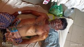 স্বামীকে স্ত্রীর এসিড নিক্ষেপ ও কিশোরীর ‘ইভটিজিং’!