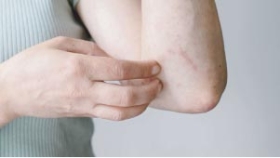 শীতের রাতে চুলকানি বাড়ে কেন?