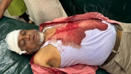 ইব্রাহিমপুরে ভেকু দিয়ে মাটি কাটা নিয়ে সংঘর্ষে ব্যবসায়ীসহ  আহত ১০