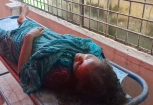 কচুয়ায় বজ্রপাতে কৃষাণীর  মৃত্যু