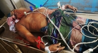 ঝড়ে গাছ পড়েছে চলন্ত সিএনজির ওপর, প্রাণ গেলো বৃদ্ধের