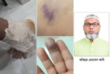 গ্যাস সংযোগের বিরোধে ব্যবসায়ীকে হত্যাচেষ্টার অভিযোগে গ্রেপ্তার ১