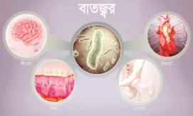 রিউম্যাটিক ফিভার বা বাতজ্বর